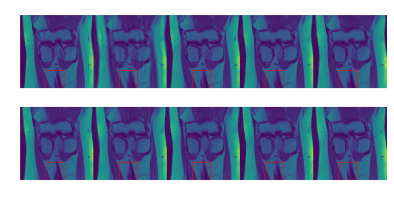 Denoising Score-Matching for Uncertainty Quantification in Inverse Problems