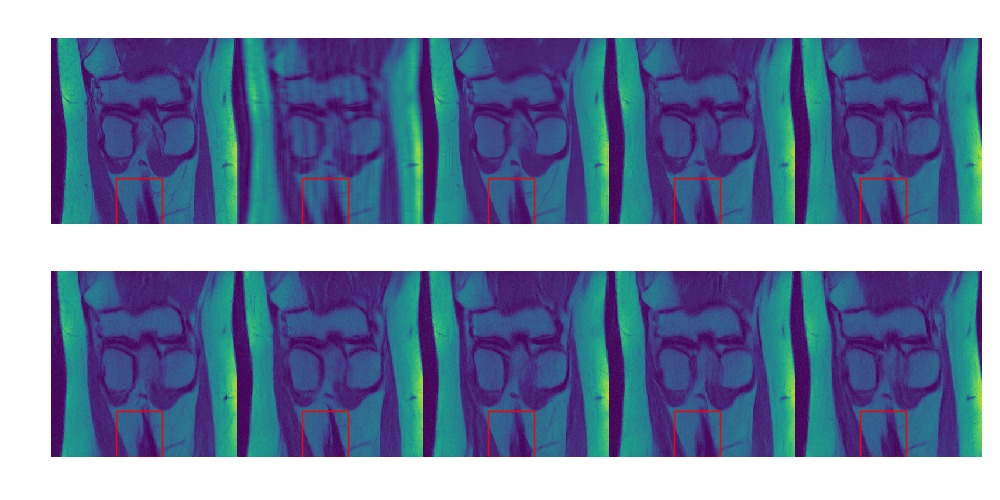 Denoising Score-Matching for Uncertainty Quantification in Inverse Problems